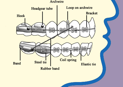 braces tooth movement works biology teeth mechanism ortho dental attached bone types invisible