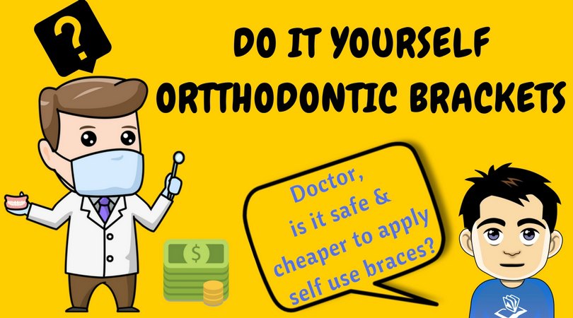 Young Men Loosing Teeth Using Fake Online ” Do It Yourself” Orthodontic Braces